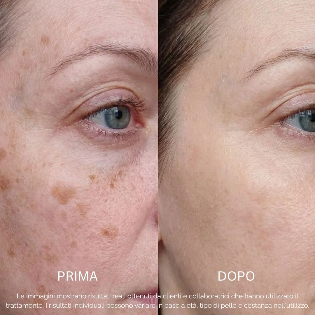 Sistema Protezione Macchie | BioInfusion + Perla Solare