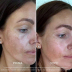 Sistema Protezione Macchie | BioInfusion + Perla Solare