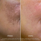 Sistema Protezione Macchie | BioInfusion + Perla Solare