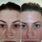 Sistema Protezione Macchie | BioInfusion + Perla Solare