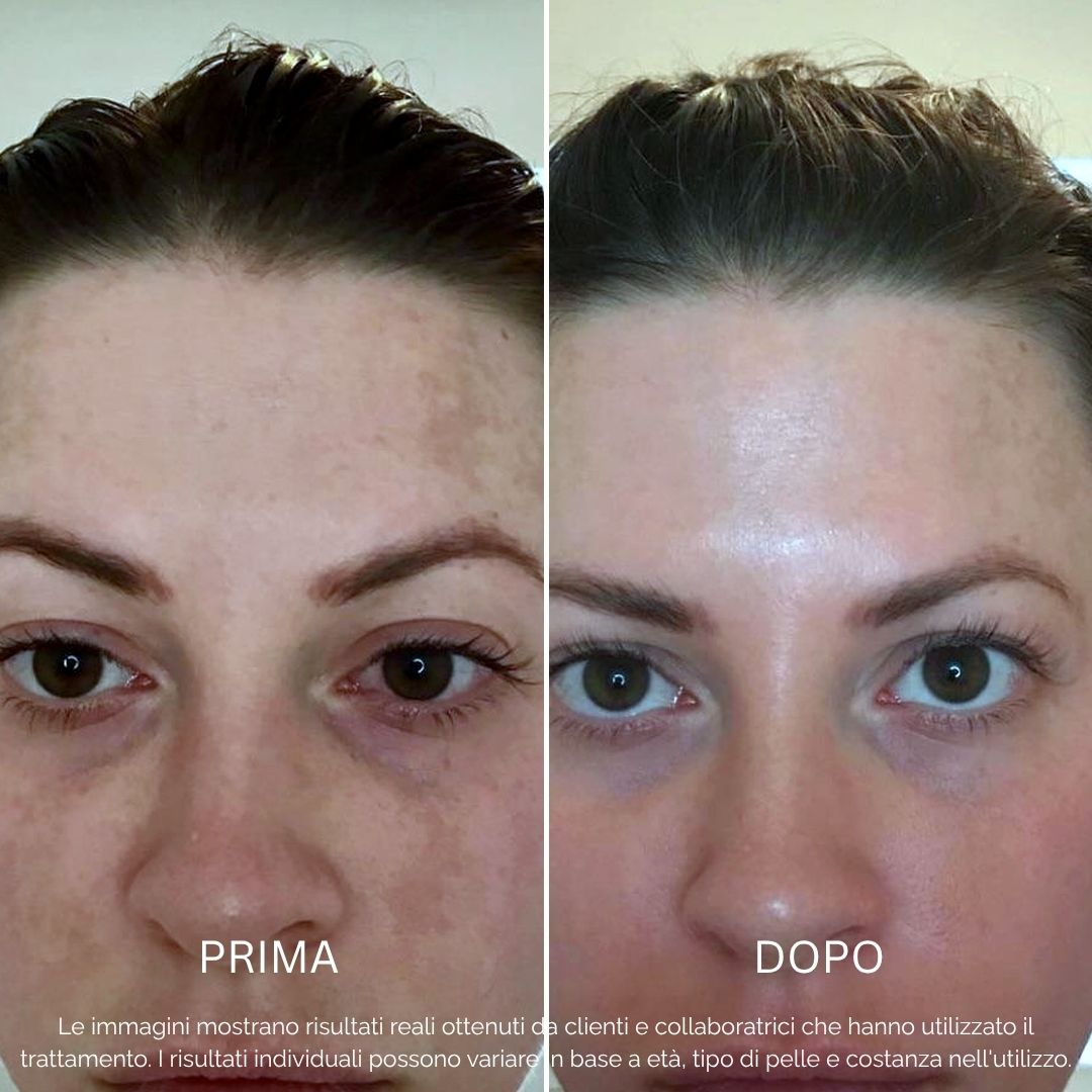 Sistema Protezione Macchie | BioInfusion + Perla Solare