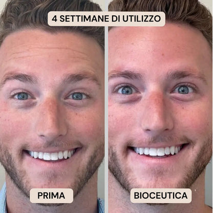BioInfusion+ | Sistema di Microinfusione (Uomo)