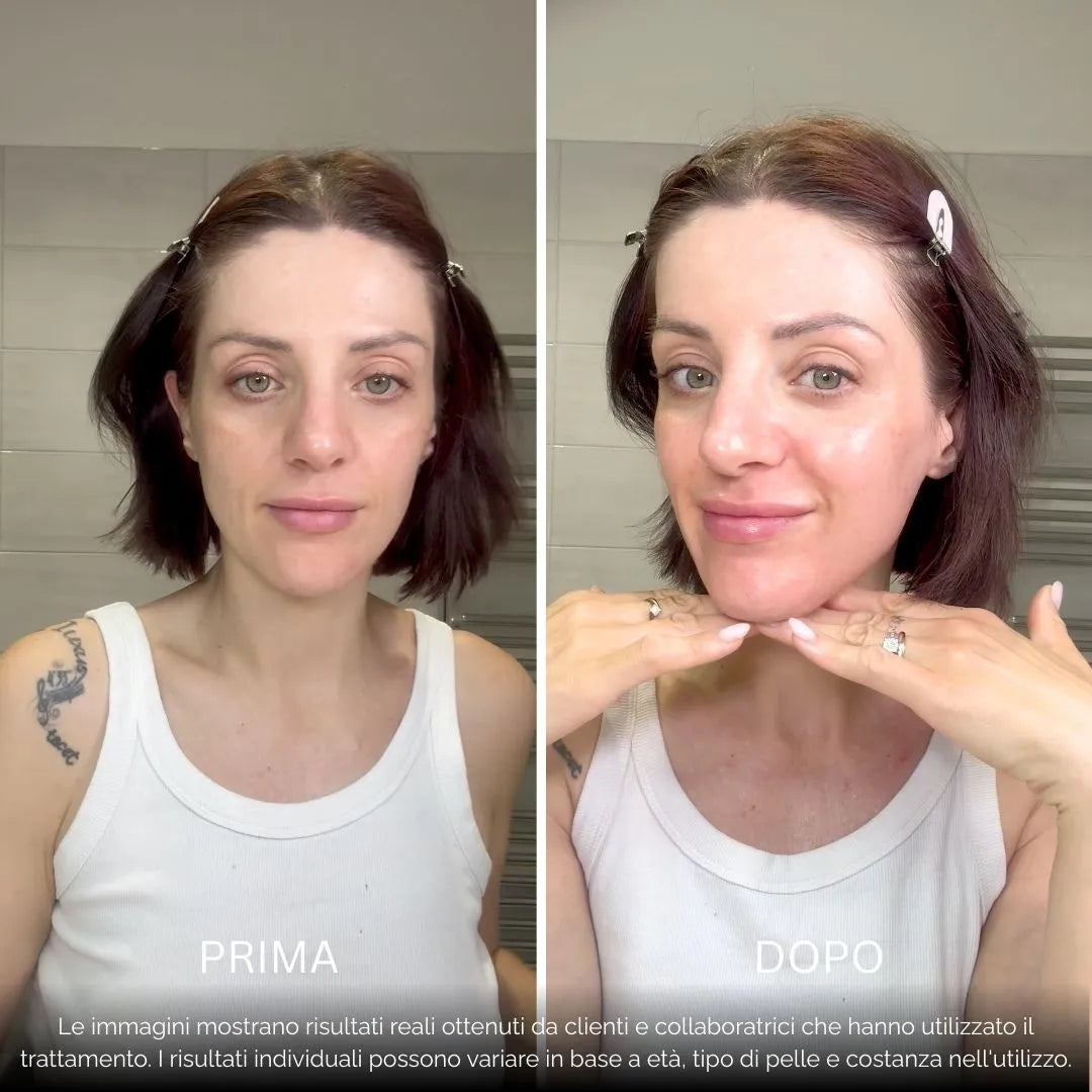 BioInfusion+ | Sistema di Microinfusione (Dear Alice)