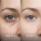 Prima e dopo 1