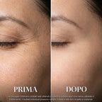 Prima e dopo 2