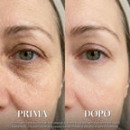 Prima e dopo 3