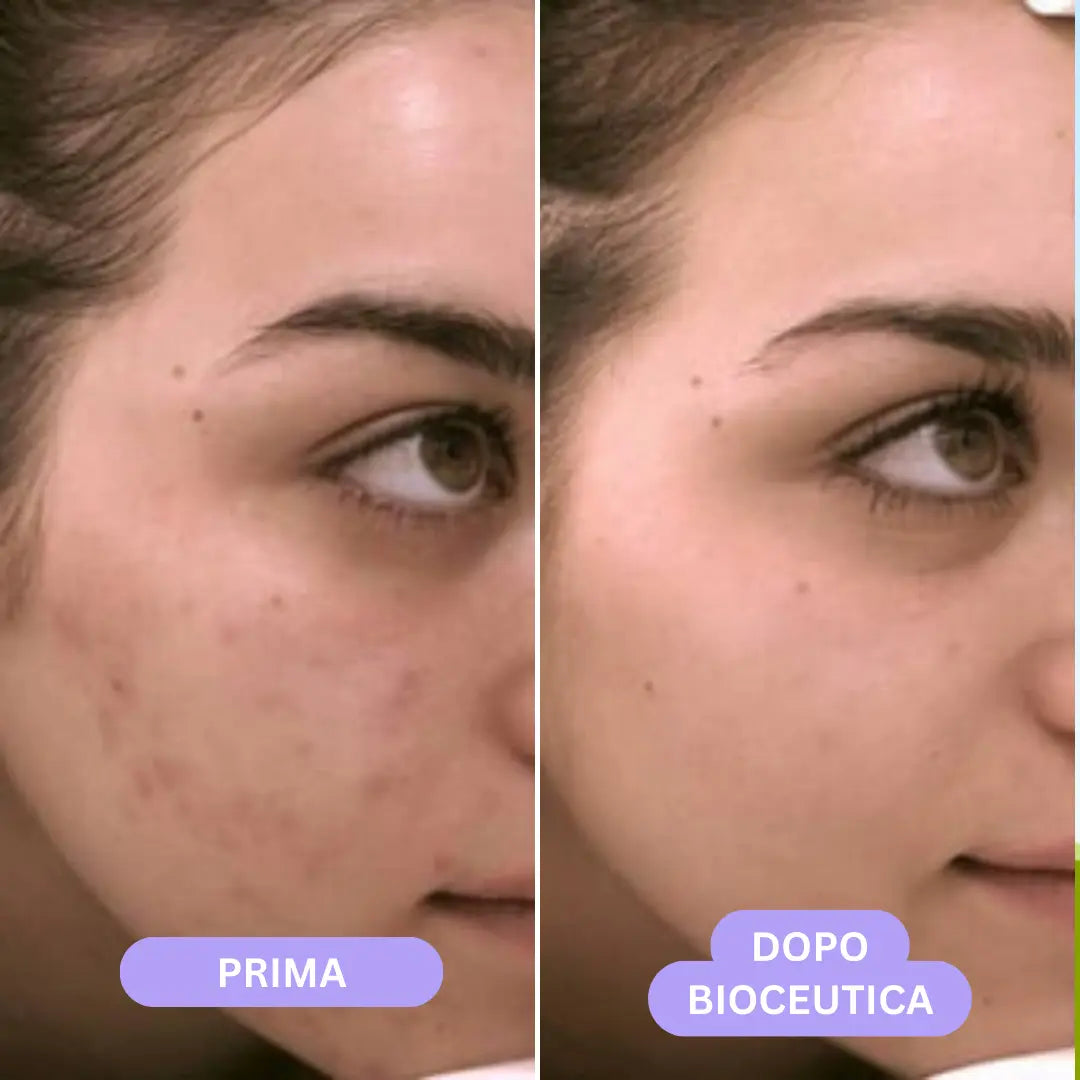 Bioceutica Milano Sistema di Infusione Microneedling – Anti-Age, Ringiovanimento Cutaneo, Microaghi in Oro 24K