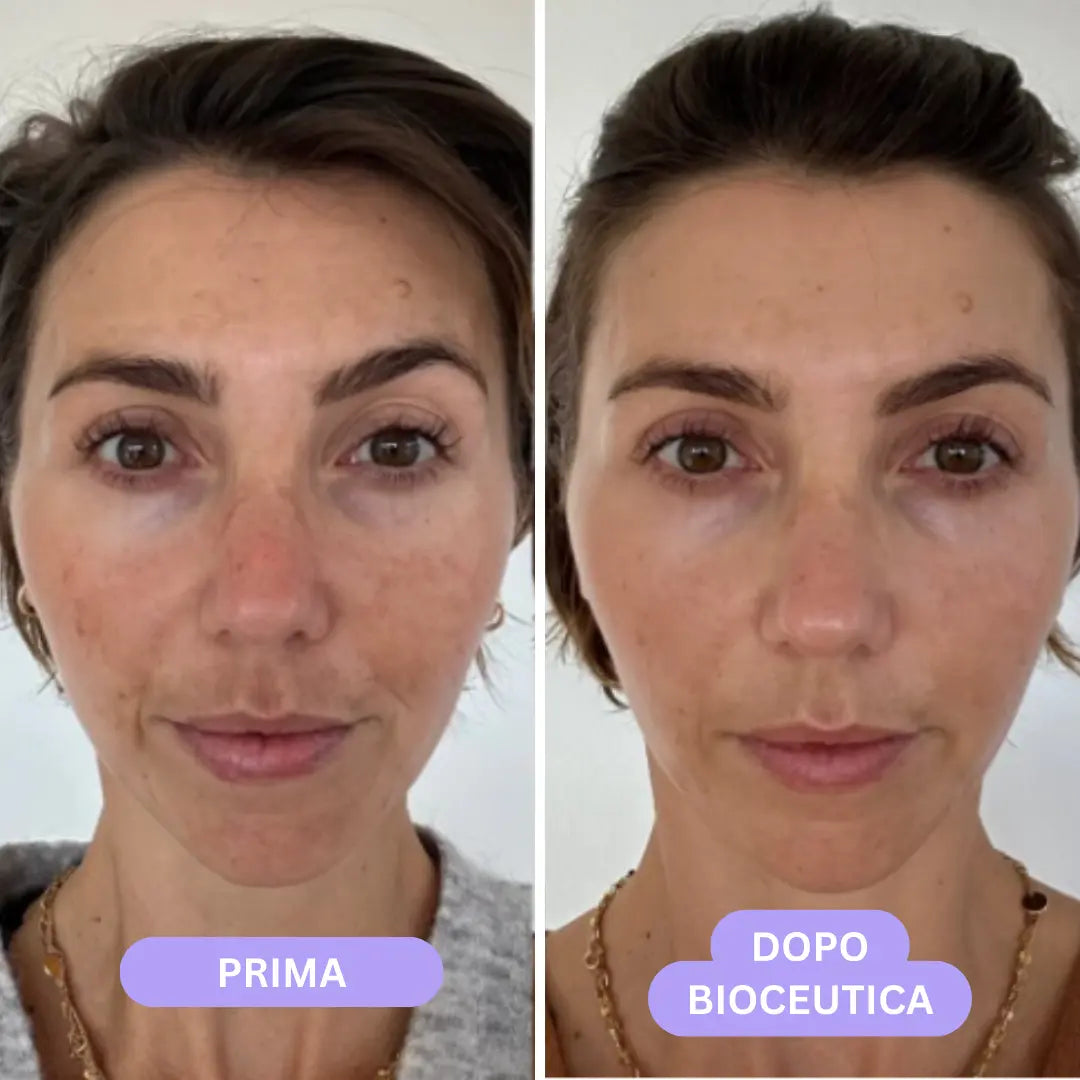 Bioceutica Milano Sistema di Infusione Microneedling – Anti-Age, Ringiovanimento Cutaneo, Microaghi in Oro 24K