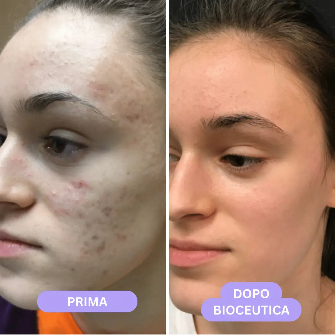 Bioceutica Milano Sistema di Infusione Microneedling – Anti-Age, Ringiovanimento Cutaneo, Microaghi in Oro 24K